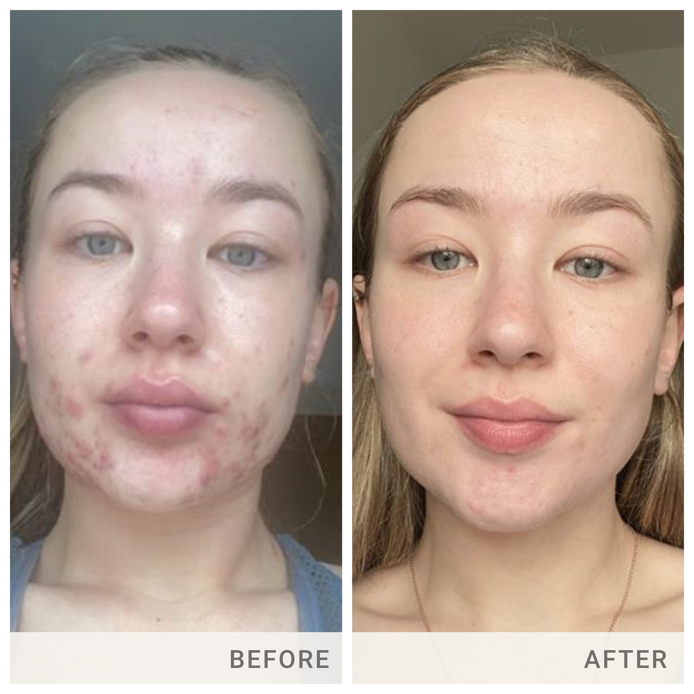 Skin Accumax® - Image 11
